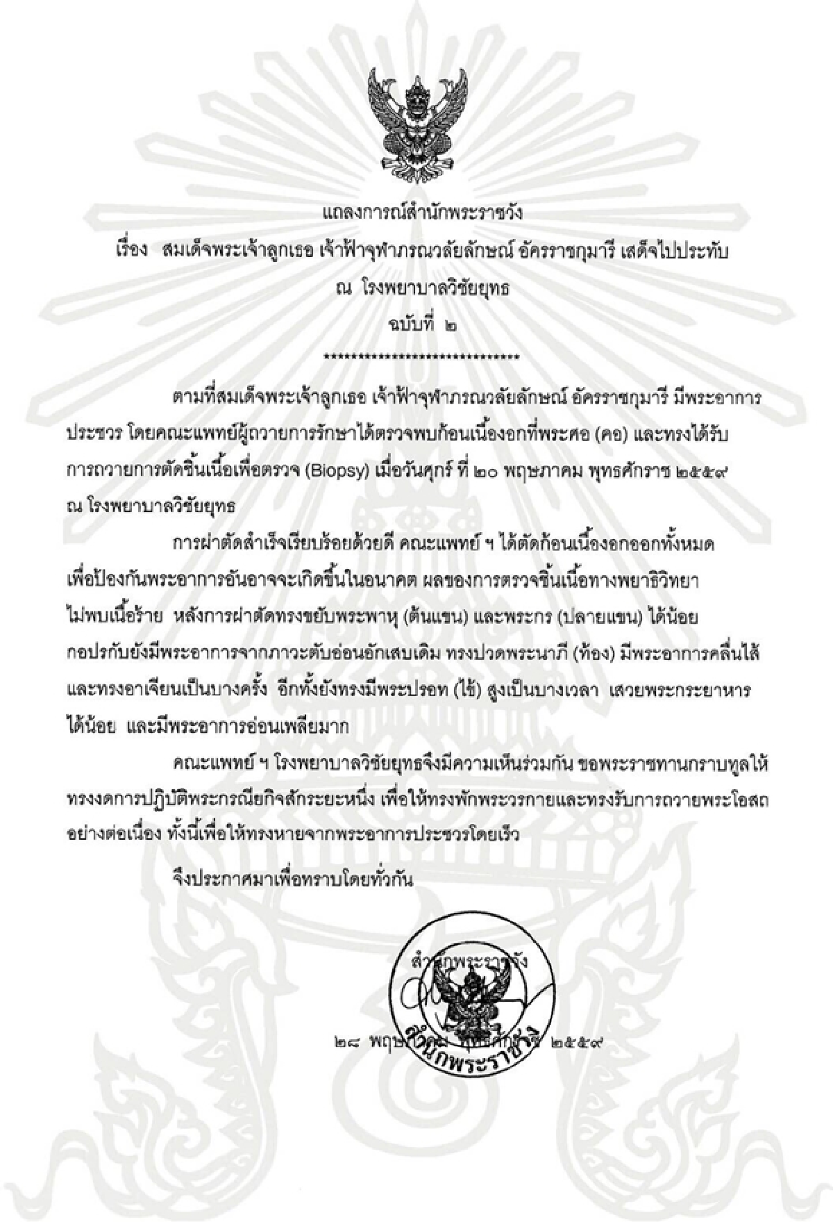 ผลผ่าตัดเนื้องอกพระศอสมเด็จเจ้าฟ้าหญิงจุฬาภรณ์เรียบร้อยดี