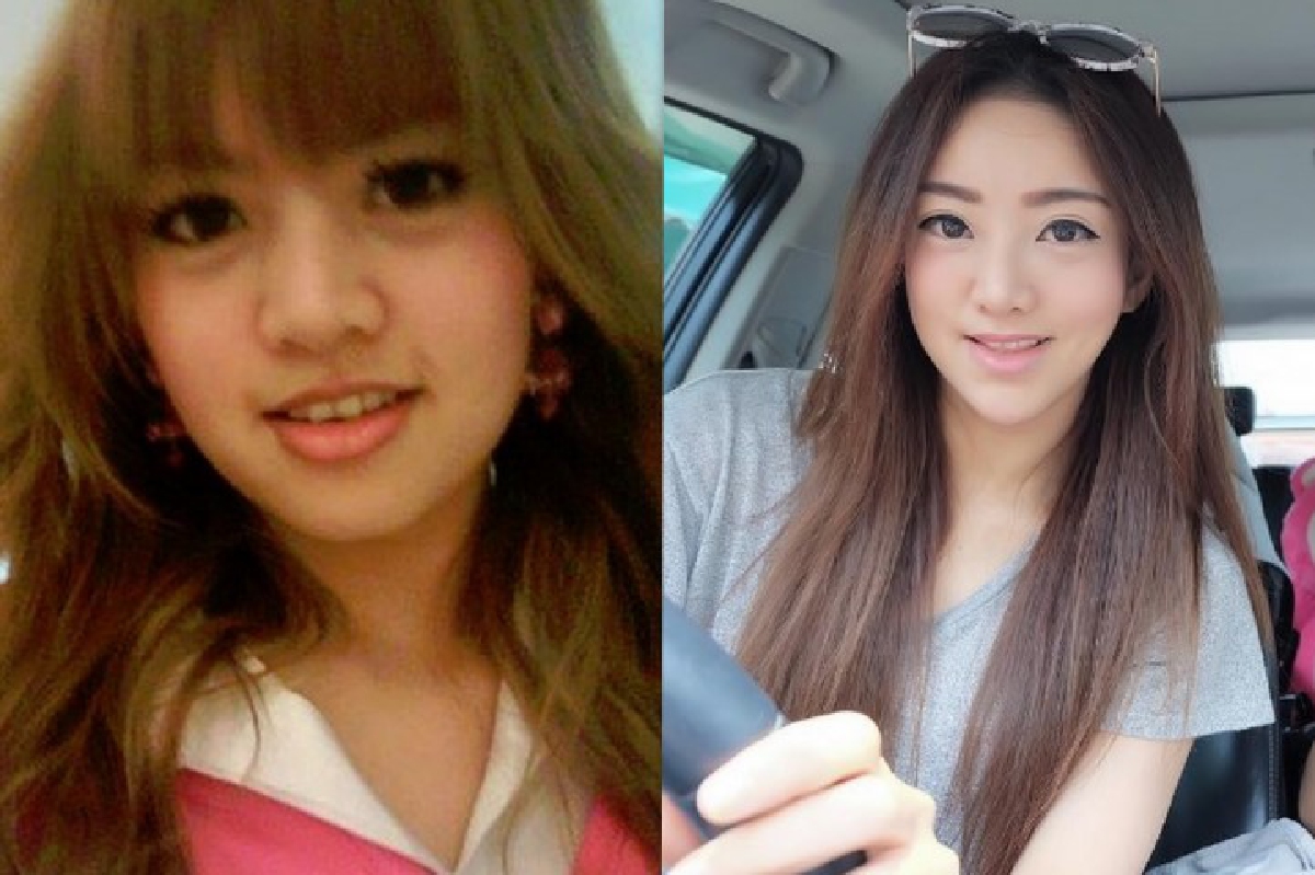 แนนนี่ Girly Berry ยันไม่ได้ศัลยกรรม หน้าเปลี่ยนเพราะโตขึ้น แนนนี่ Girly Berry ยันไม่ได้ศัลยกรรม หน้าเปลี่ยนเพราะโตขึ้น