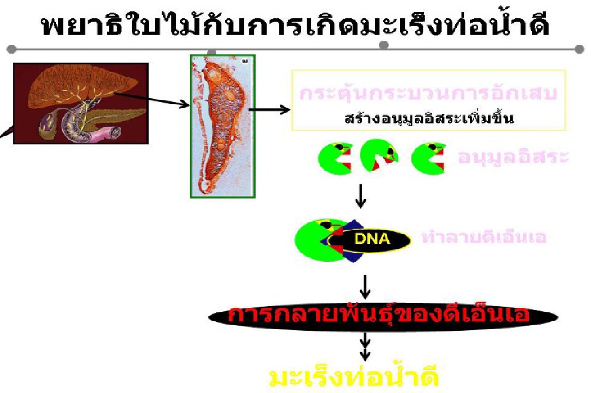 ครม.อนุมัติยุทธศาสตร์กำจัดปัญหาพยาธิใบไม้ตับ-มะเร็งท่อน้ำดี ครม.อนุมัติยุทธศาสตร์กำจัดปัญหาพยาธิใบไม้ตับ-มะเร็งท่อน้ำดี