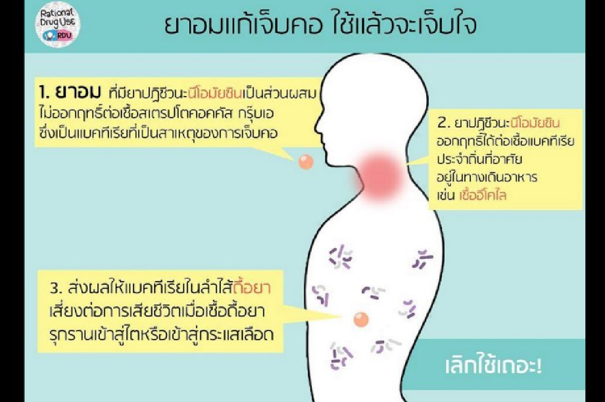 จี้สธ.ถอดยาอม "นีโอมัยซิน" ออกจากบัญชีหลังพบเสี่ยงดื้อยา จี้สธ.ถอดยาอม "นีโอมัยซิน" ออกจากบัญชีหลังพบเสี่ยงดื้อยา