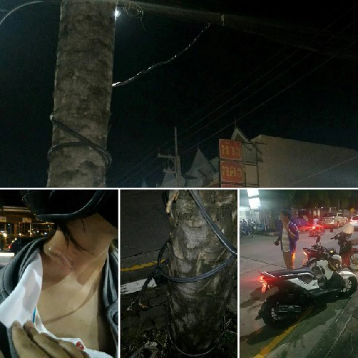 หวิดดับ!สาวภูเก็ตขี่จักรยานยนต์เจอสายไฟห้อยพันคอล้มเจ็บ