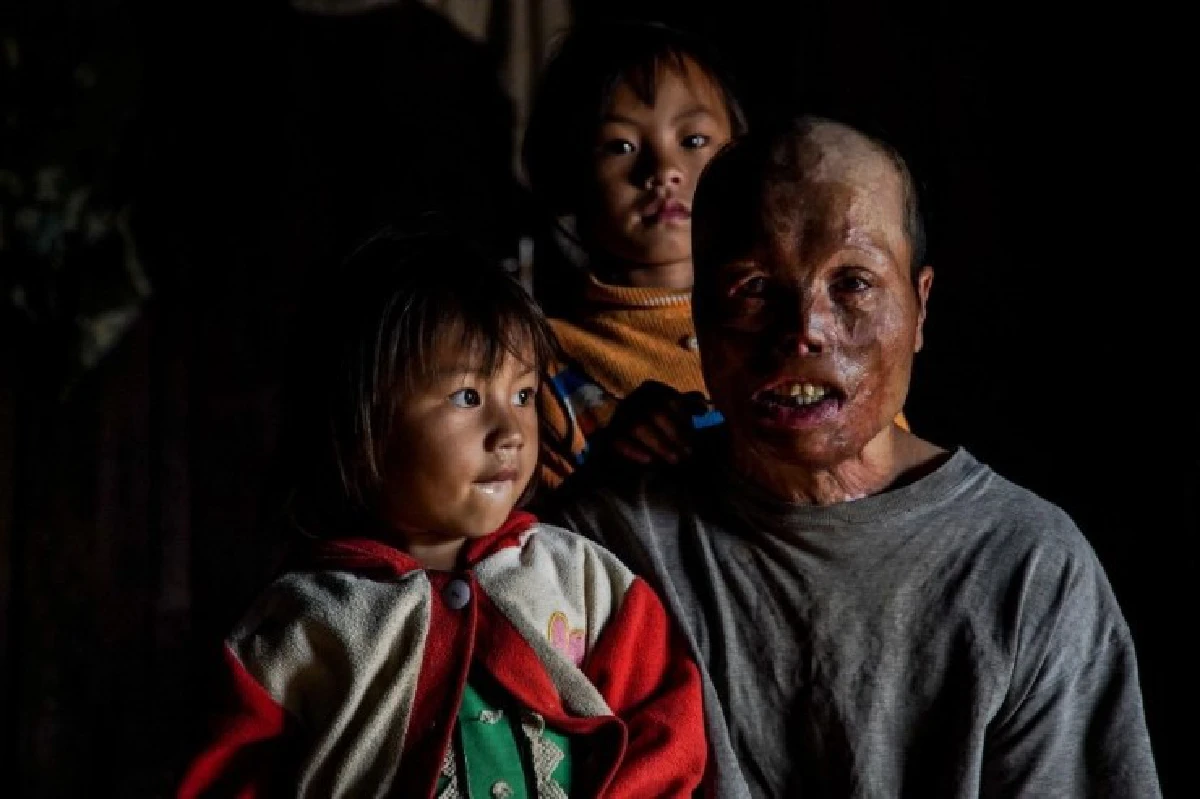 ระเบิดจากสหรัฐ ยังคงเหลือในลาวถึง 80 ล้านลูก