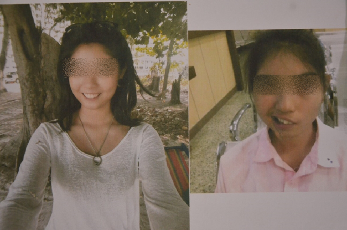 แม่ร้องสื่อลูกสาวม.5ถูกครูปาแก้วใส่ปากเบี้ยว