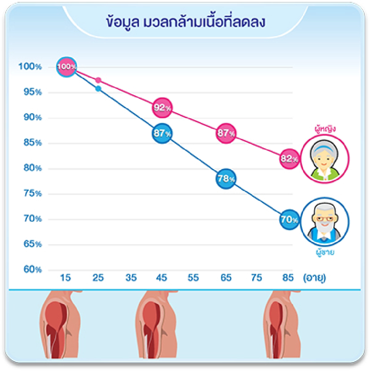 วงการแพทย์ตื่นตัว หลังพบว่าผู้สูงอายุ 60+ ต้องใส่ใจอาการกล้ามเนื้อลีบ และอ่อนแรงอย่างใกล้ชิด