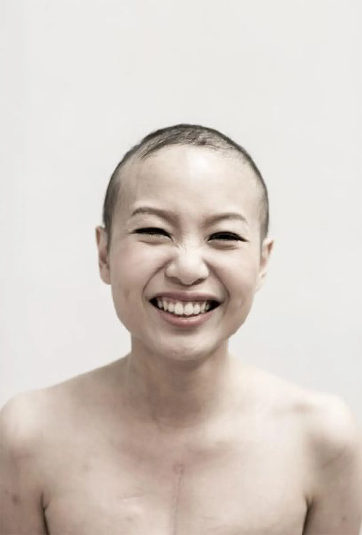 ศิรินทิพย์ ขัติยะกาญจน์ พลังจากโรคร้าย ปาฏิหาริย์ที่เป็นจริง