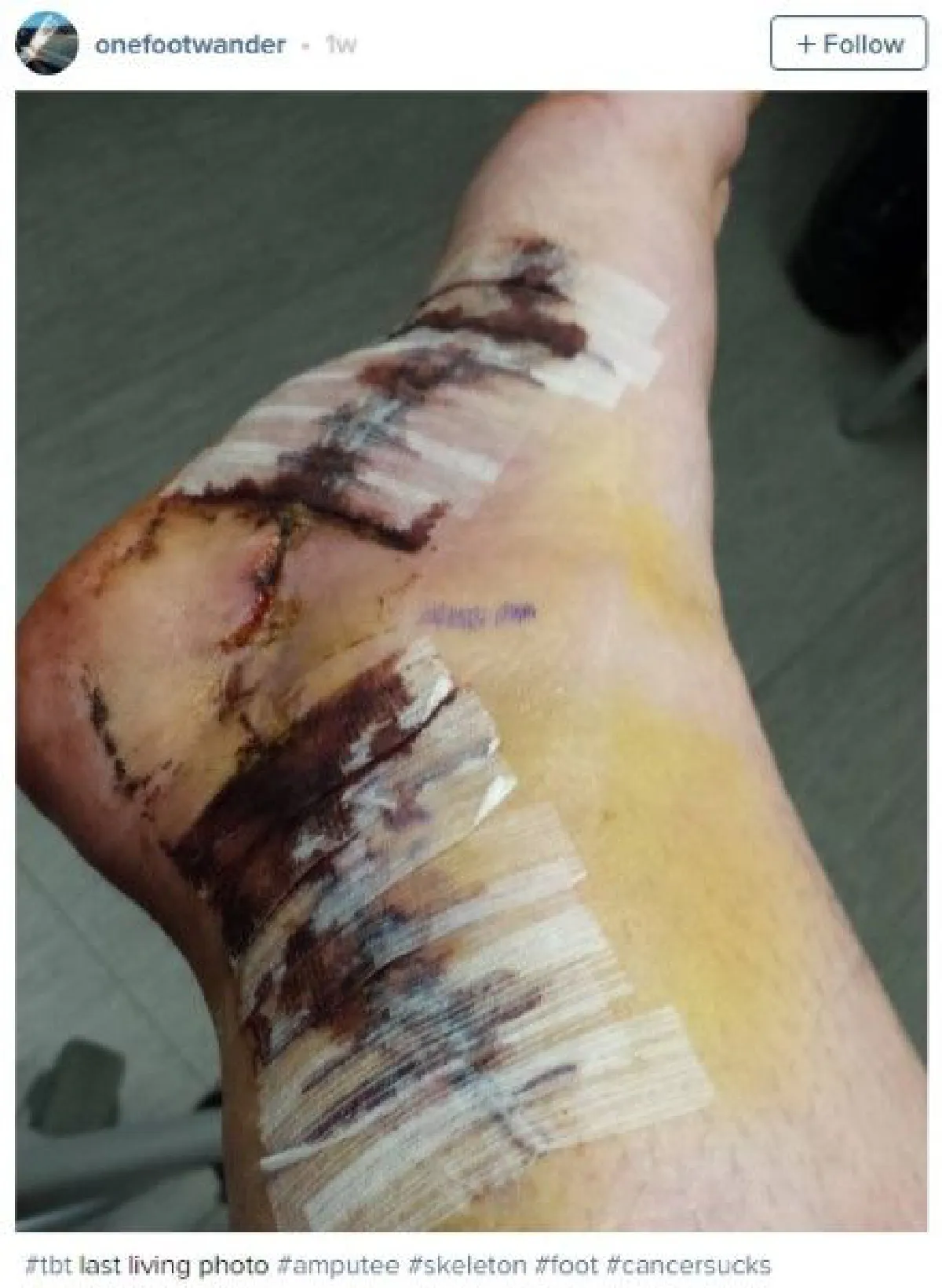 พบกับอินสตาแกรมของกระดูกเท้า ที่เจ้าของตั้งใจจะพาไปเที่ยวรอบโลก!