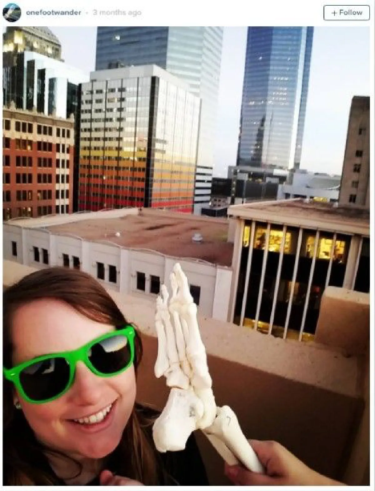 พบกับอินสตาแกรมของกระดูกเท้า ที่เจ้าของตั้งใจจะพาไปเที่ยวรอบโลก!