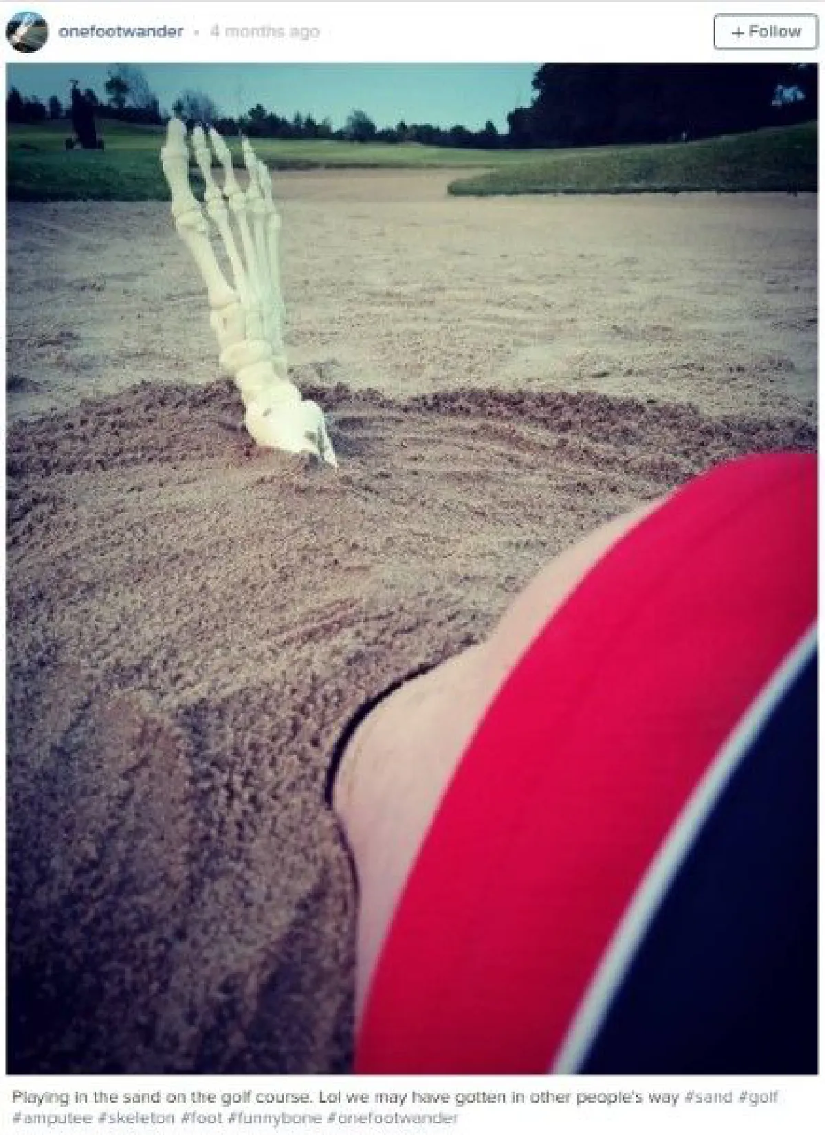 พบกับอินสตาแกรมของกระดูกเท้า ที่เจ้าของตั้งใจจะพาไปเที่ยวรอบโลก!