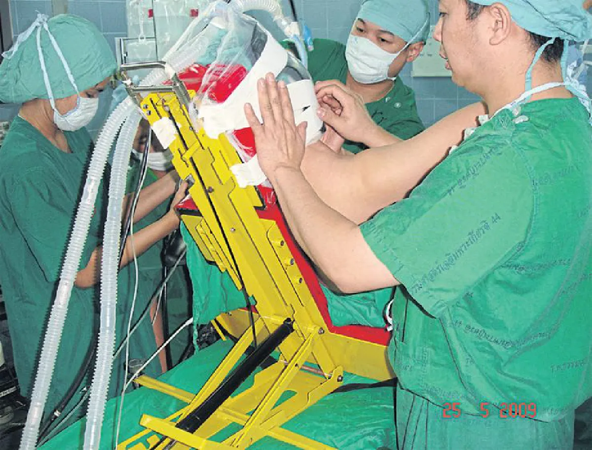 Beach Chair อุปกรณ์ช่วยผ่าตัดข้อไหล่