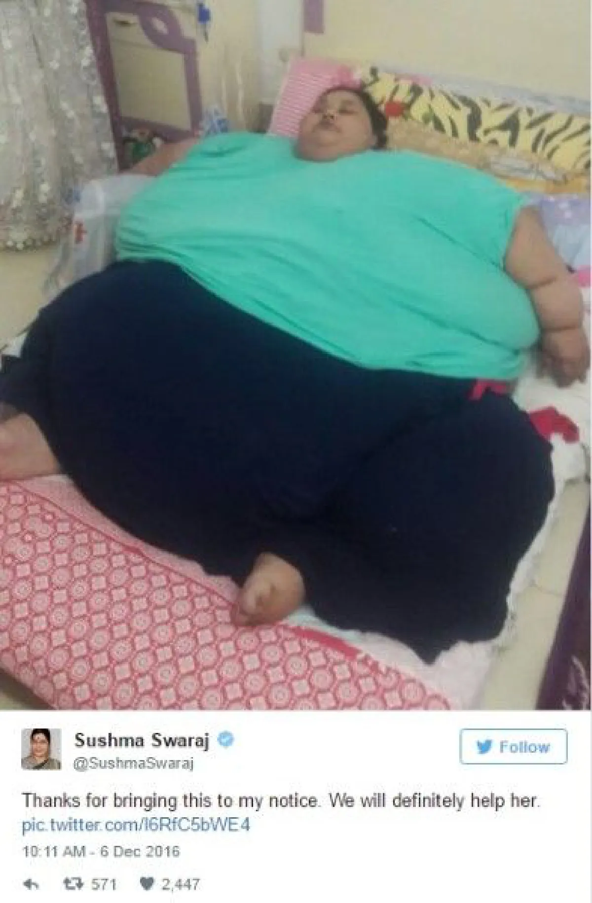 หญิงอ้วนที่สุดในโลกลดน้ำหนักได้แล้ว 50 กิโลกรัม