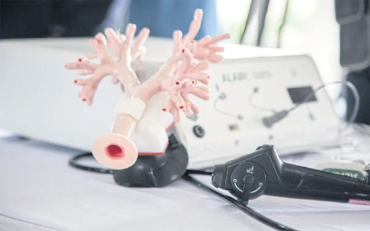 นวัตกรรมส่องกล้อง ทางเลือกใหม่เพื่อผู้ป่วยโรคหืดขั้นรุนแรง