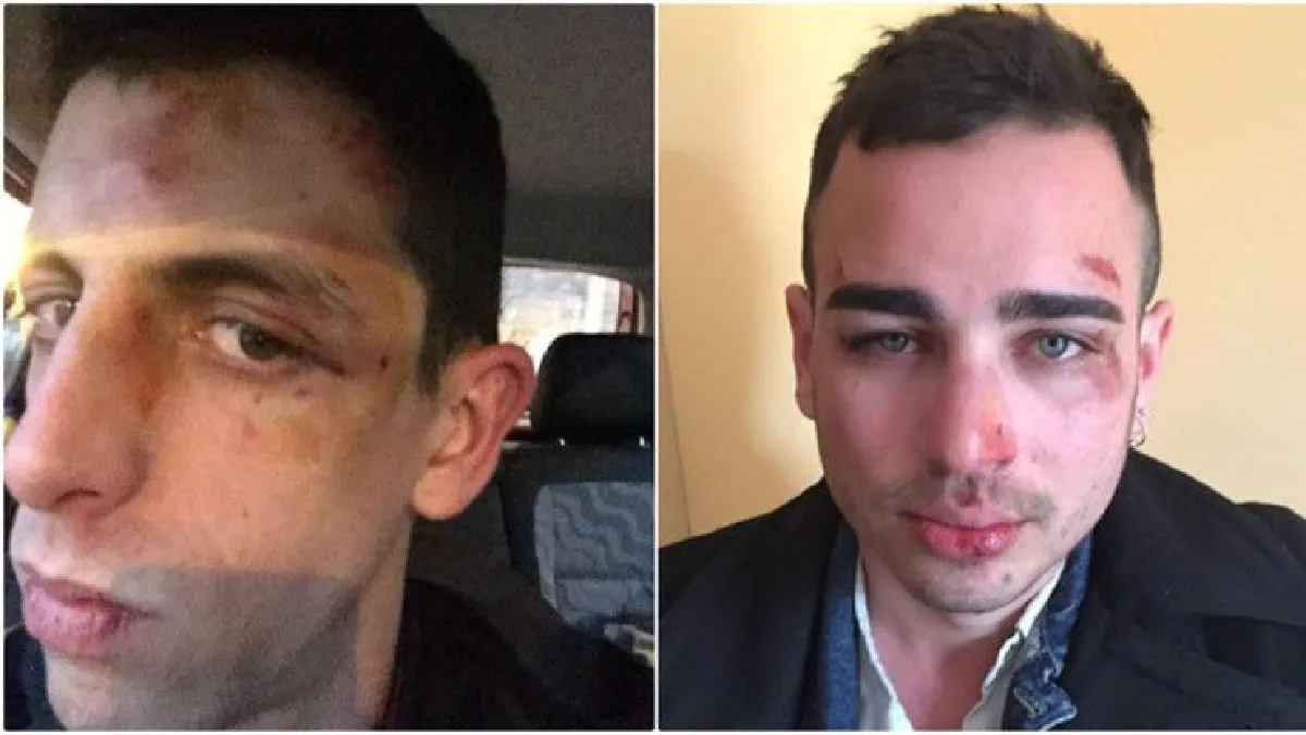 ผู้สนับสนุน LGBT ออกมาชุมนุม หลังคู่รักเกย์ถูกกระทืบเพราะจูบกัน