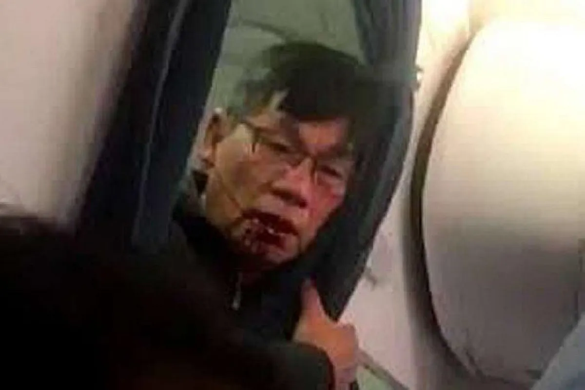'Everything is injured,' says United passenger