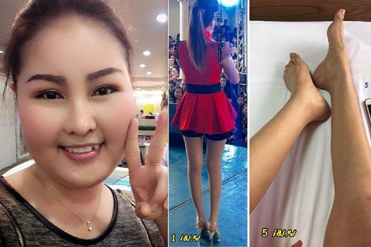 แทบยืนไม่ไหว! หญิงลี เผยอาการป่วยทำขาลีบเล็กลงเท่าไอโฟน แทบยืนไม่ไหว! หญิงลี เผยอาการป่วยทำขาลีบเล็กลงเท่าไอโฟน