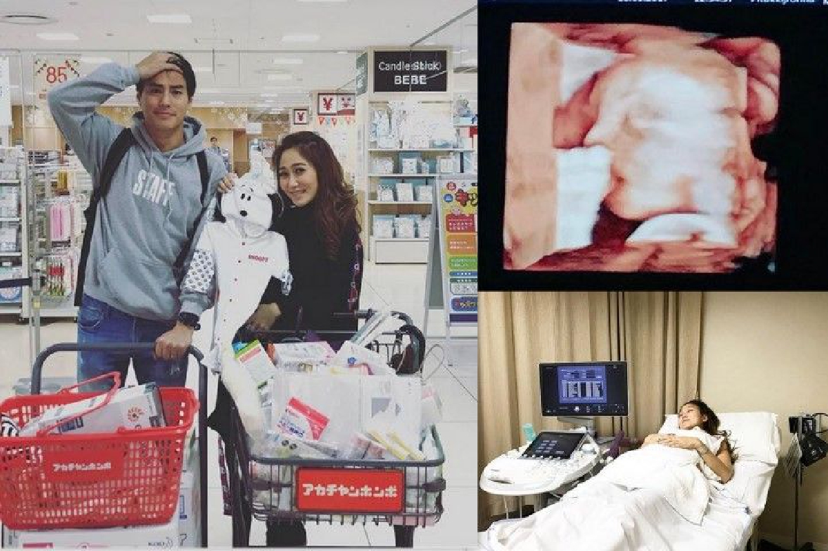 ไม่เห่อเท่าไหร่! นาวิน ต้าร์ เผยภาพอัลตร้าซาวด์ลูก ซื้อของใช้เตรียมไว้แล้ว ไม่เห่อเท่าไหร่! นาวิน ต้าร์ เผยภาพอัลตร้าซาวด์ลูก ซื้อของใช้เตรียมไว้แล้ว