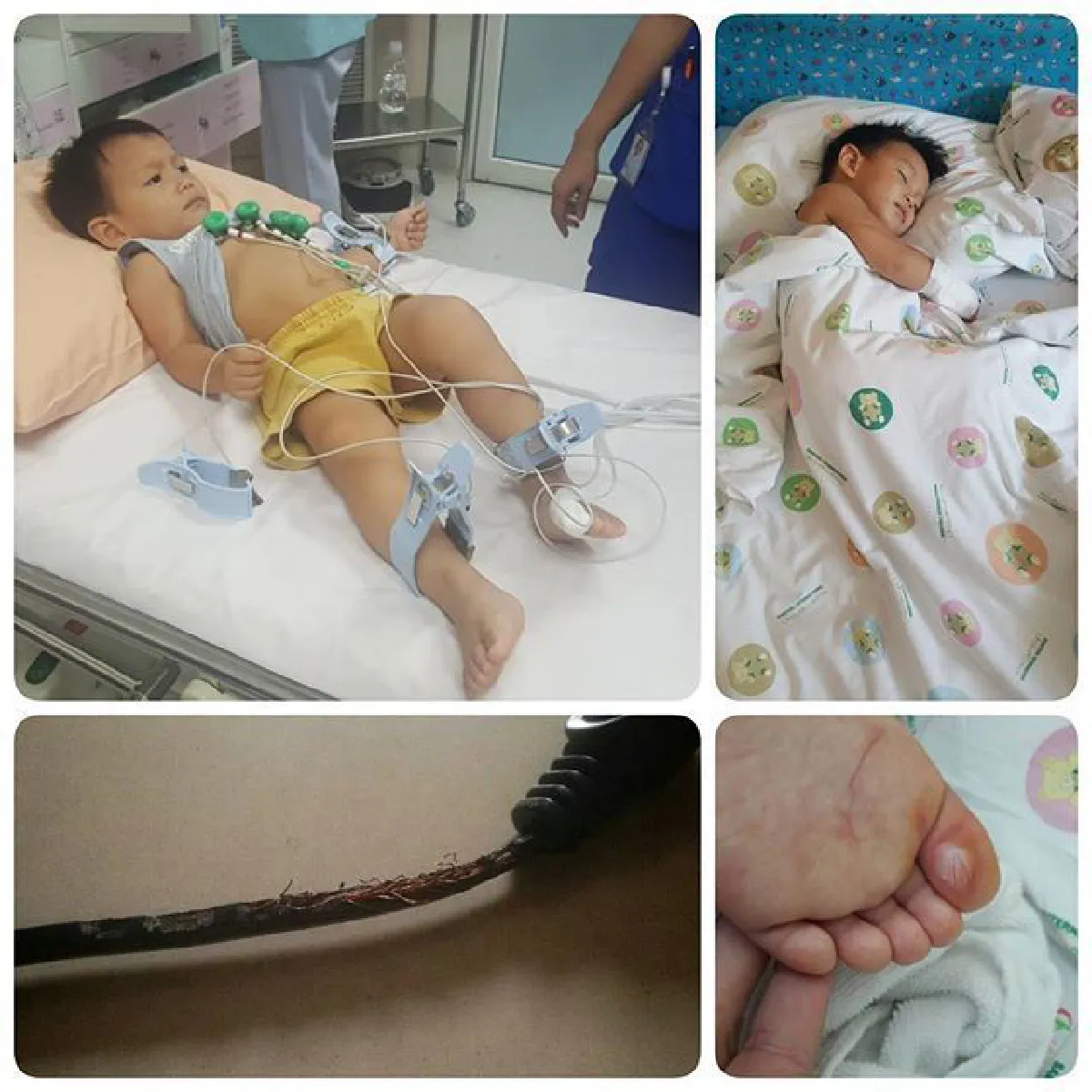ปีเตอร์ คอร์ป หายห่วง! ลูกชายไม่มีอาการผิดปกติหลังถูกไฟช็อต