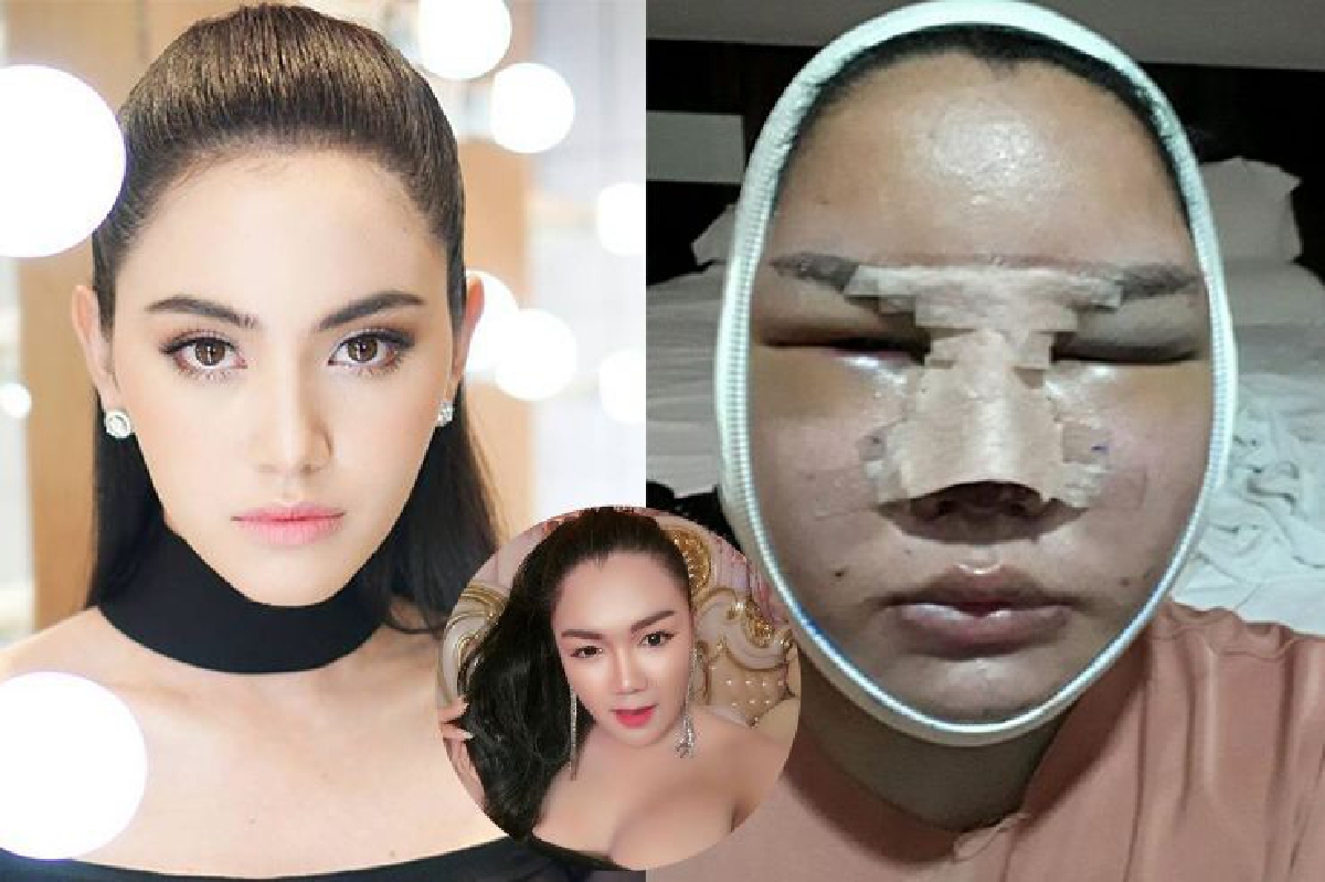 สาวสองชาวลาวทุ่มเงินล้าน แปลงโฉมให้เหมือน ใหม่ ดาวิกา สาวสองชาวลาวทุ่มเงินล้าน แปลงโฉมให้เหมือน ใหม่ ดาวิกา