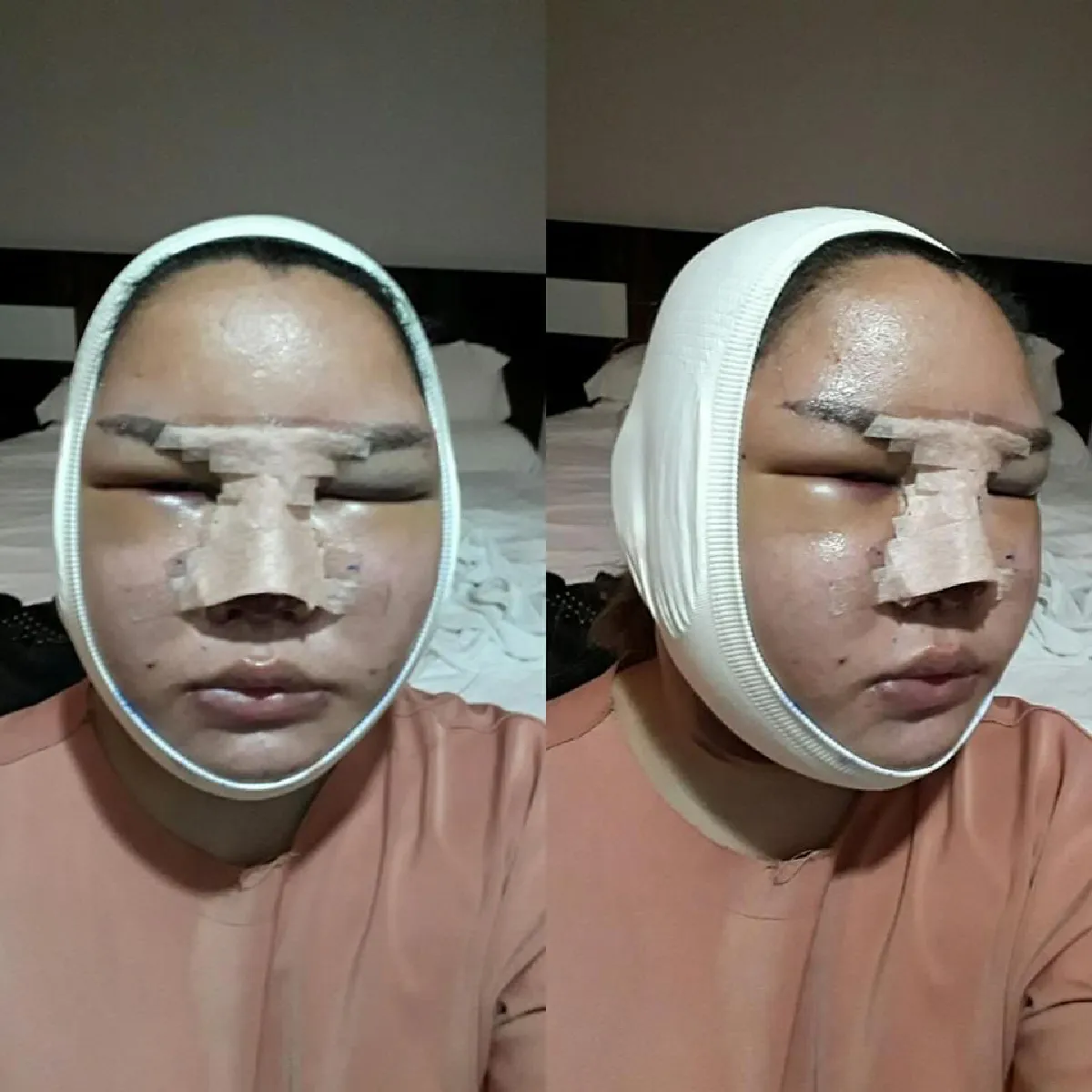 สาวสองชาวลาวทุ่มเงินล้าน แปลงโฉมให้เหมือน ใหม่ ดาวิกา