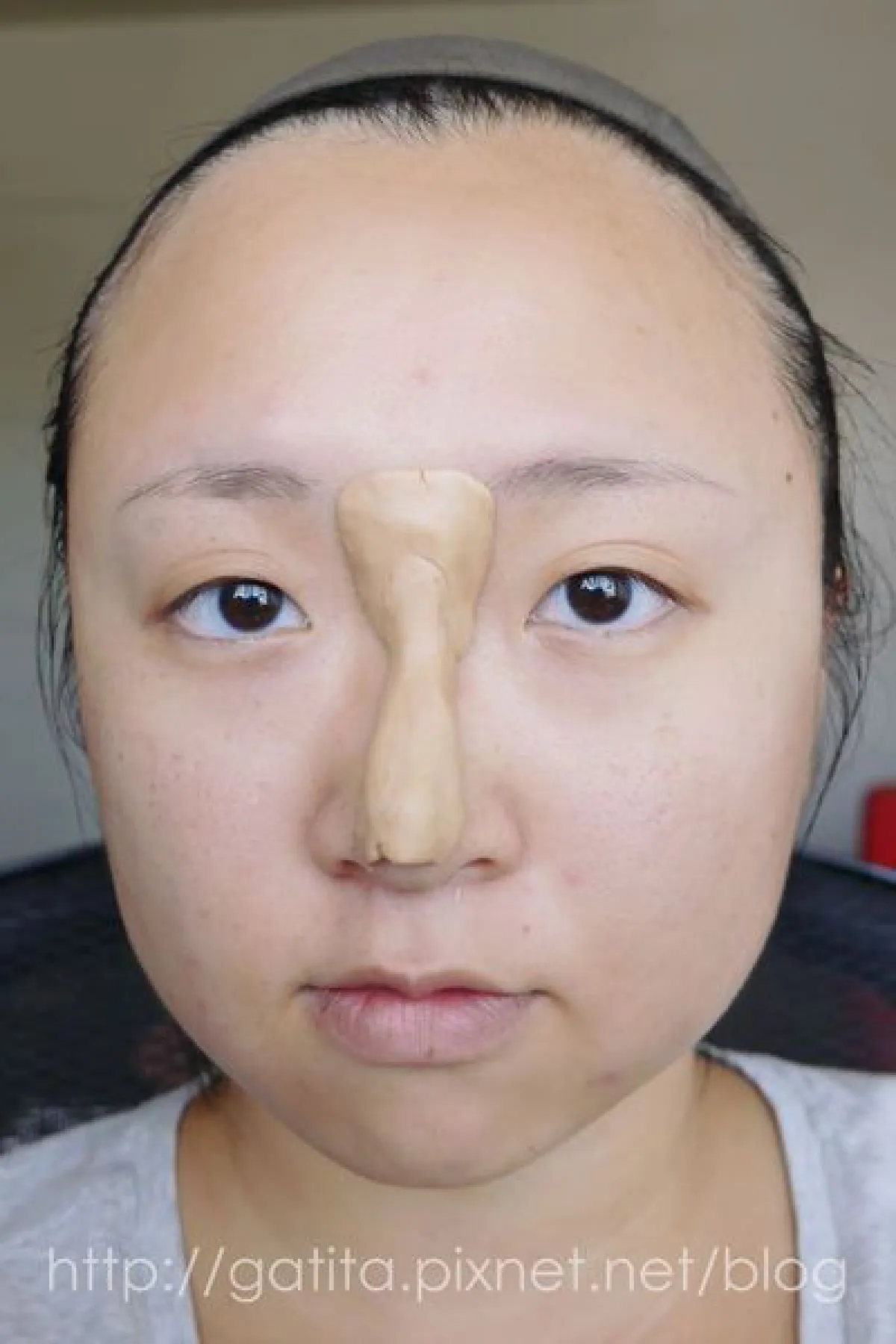 ดั้งพุ่งไม่ง้อมีดหมอ ด้วยแป้งและวาสลีน