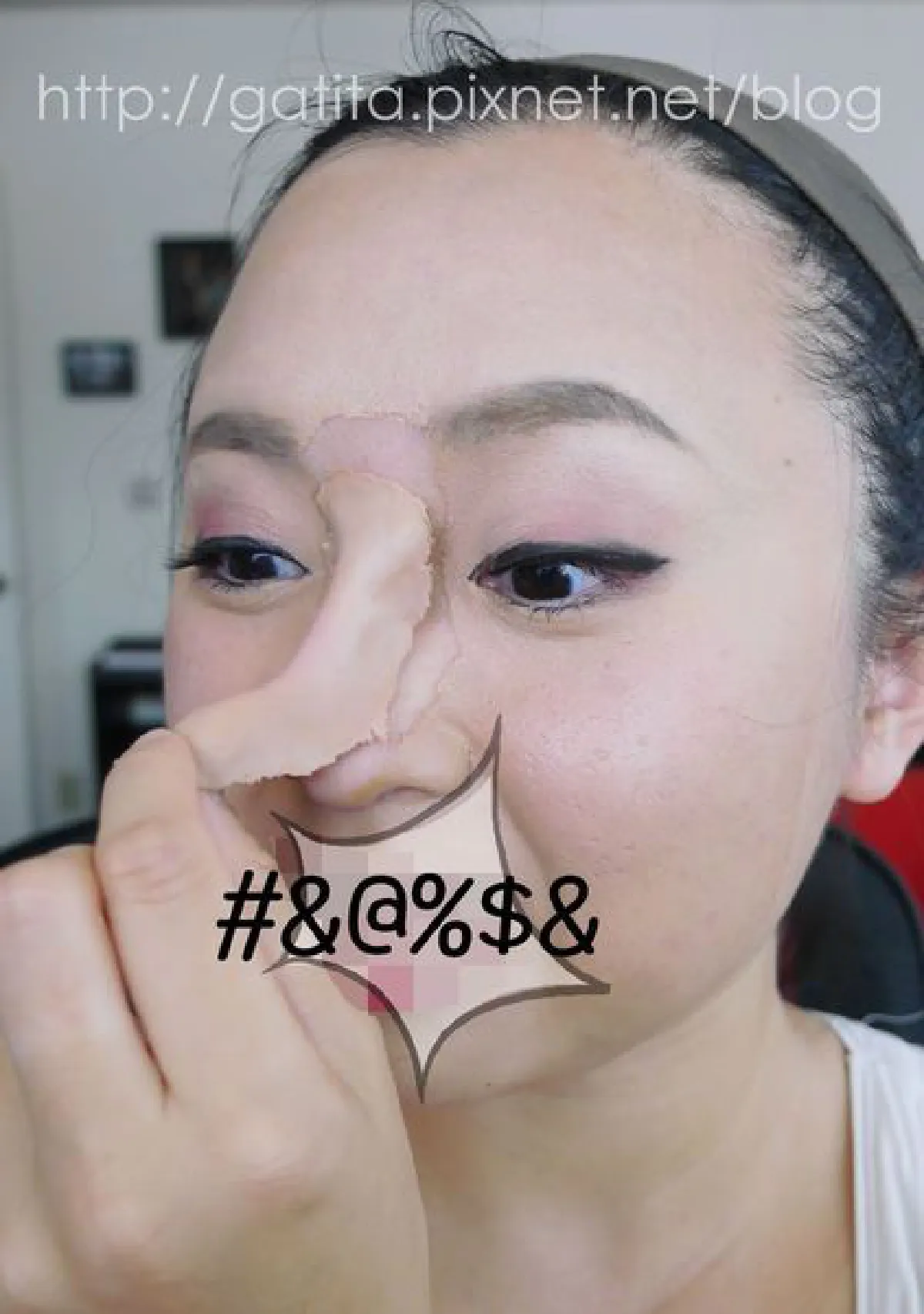 ดั้งพุ่งไม่ง้อมีดหมอ ด้วยแป้งและวาสลีน