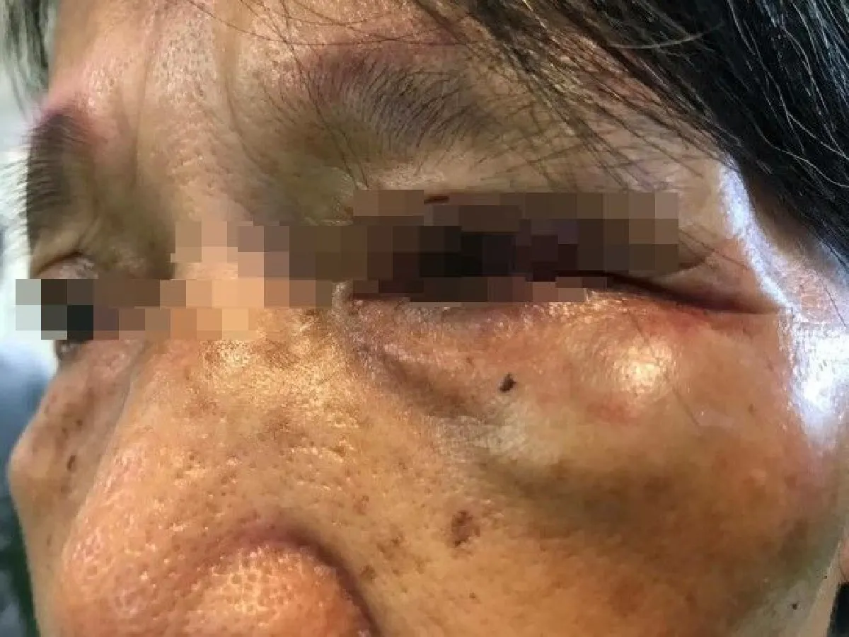 หนุ่มฉุนโดนทวงค่าตั๋วเรือ 5 บาท เอาขวดฟาด-ต่อยหน้า คุณยายวัย 70 ปี