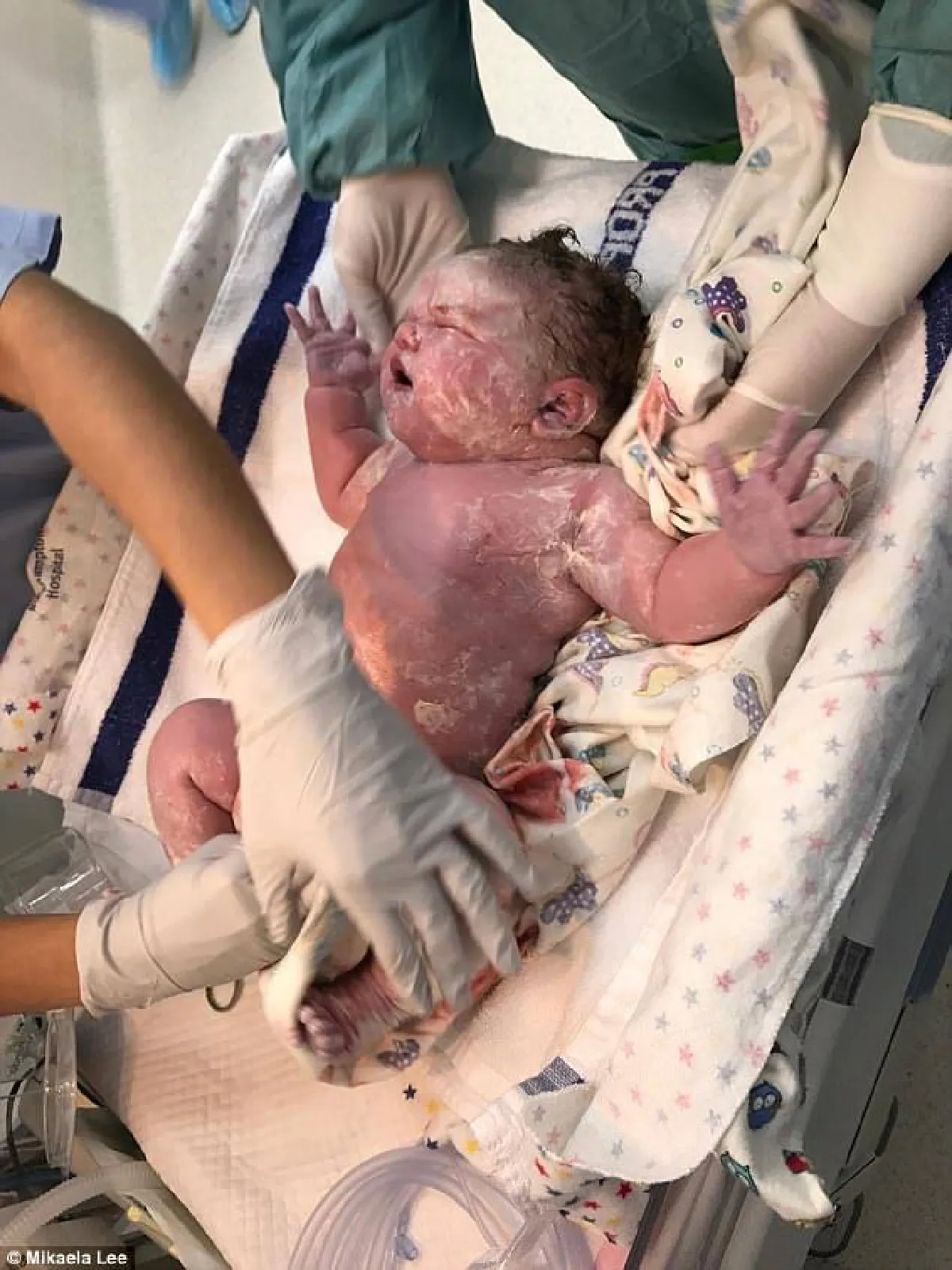 ทารกไซส์ยักษ์ ทุบสถิติน้ำหนักตัวแรกเกิดมากถึง 6 กิโลกรัม!