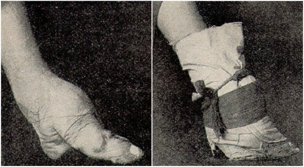 มาดูแฟชั่น “เท้าดอกบัว” ในยุคจีนโบราณที่แปลกและทรมานสุดๆ