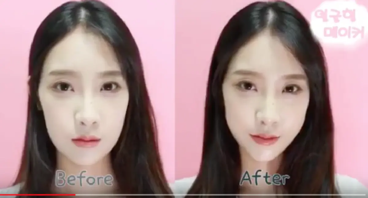 สวยไม่ง้อมีดหมอ สาวเกาหลียกกระชับหน้าด้วยเทปกาว