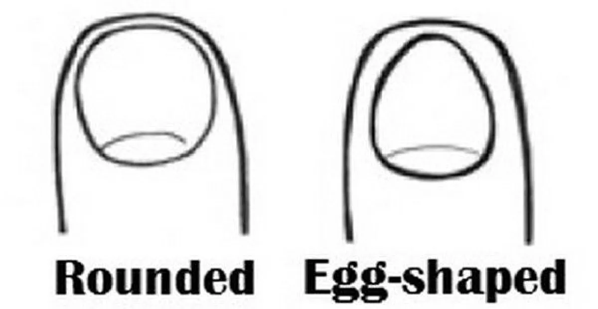 รู้หรือไม่ รูปทรงของเล็บสามารถบอกลักษณะนิสัยได้!