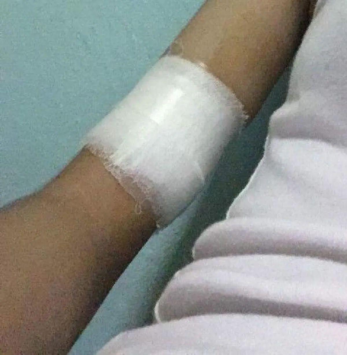 นักศึกษาสาวรีวิวการฝังยาคุมกำเนิดฟรี รับผิดชอบต่อตัวเองและสังคม