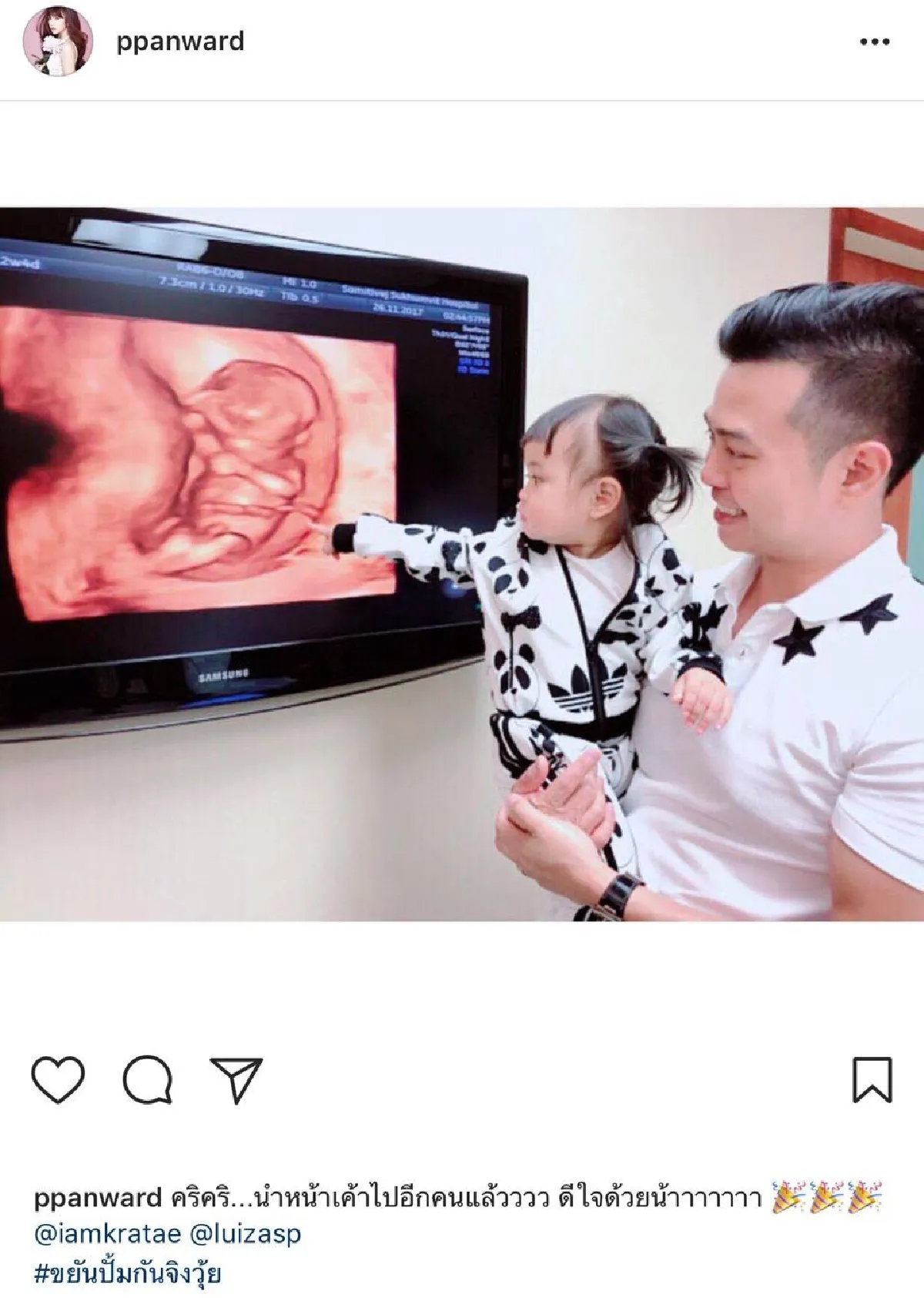 "หลุย” เฮ! “กระแต" ตั้งครรภ์ลูกคนที่สองแล้ว 3 เดือน