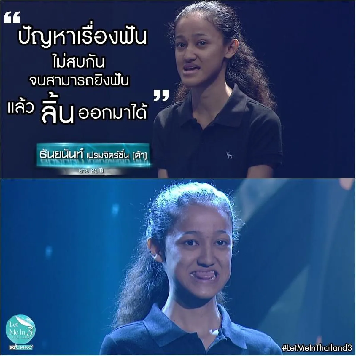 ศัลยกรรมพลิกชีวิต! ด้า ธันยนันท์ จากสาวคางยื่นเป็นสาวหน้าลูกครึ่ง