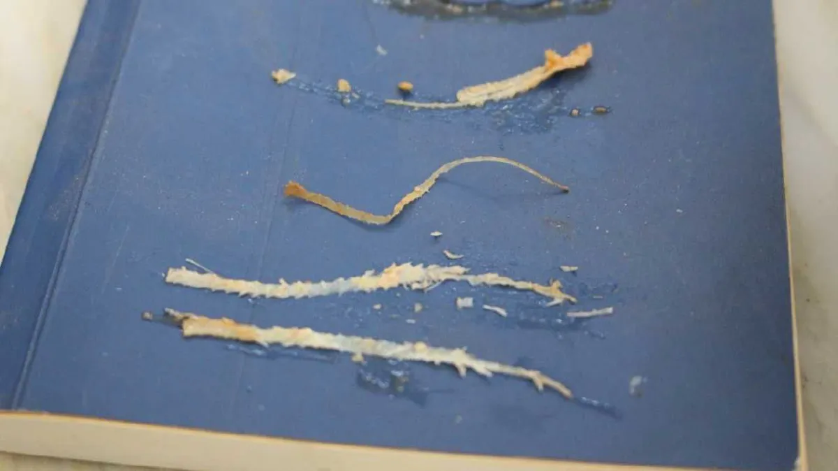 ซื้อปลากระป๋องมากินแต่กลับพบสิ่งเจือปนคล้ายพยาธิ วอนหน่วยงานช่วยตรวจสอบ