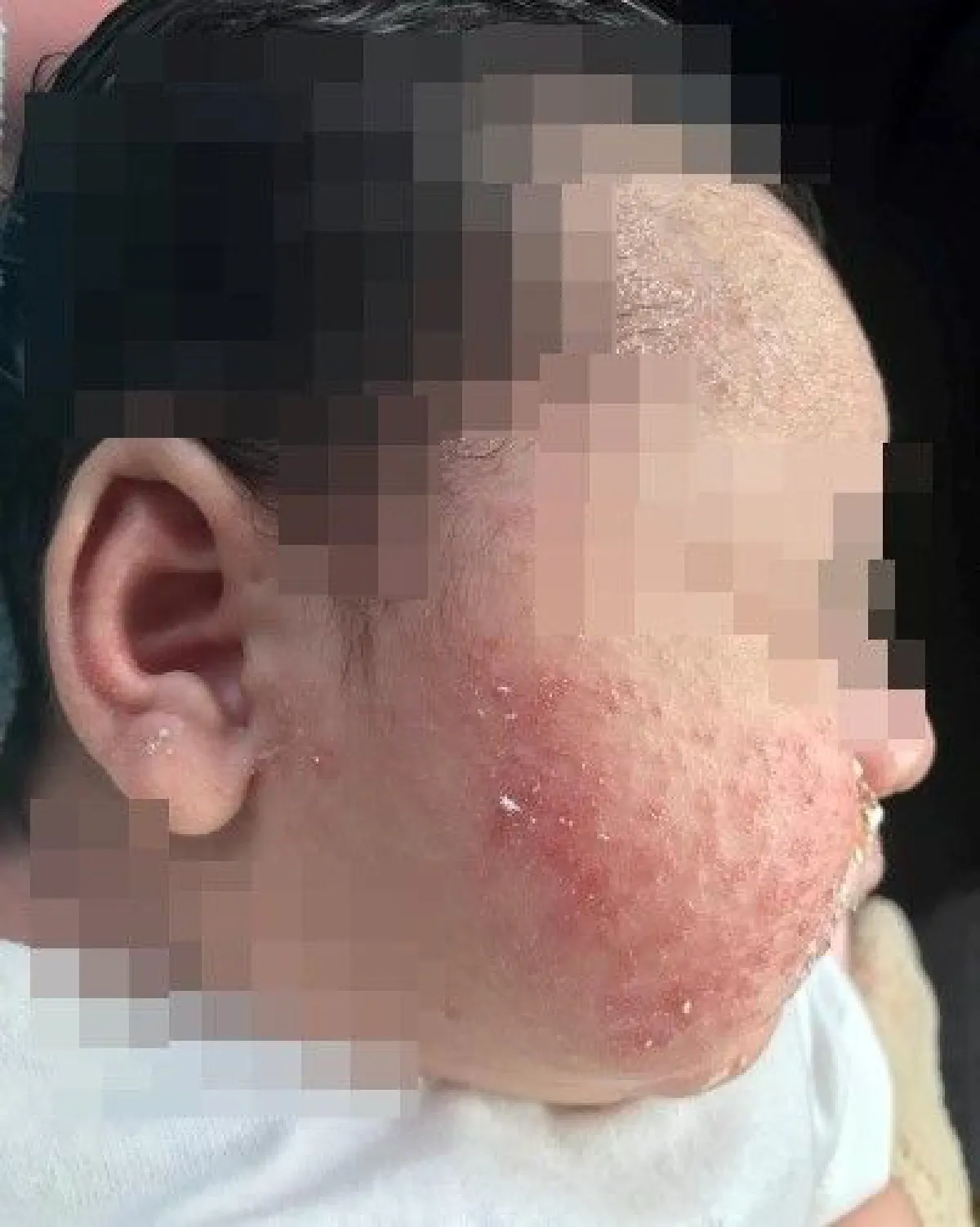 ภัยสังคม! คุณแม่โพสต์เตือนระวังนมผงปลอมที่มาเลเซีย-ทำลูกแพ้หนัก