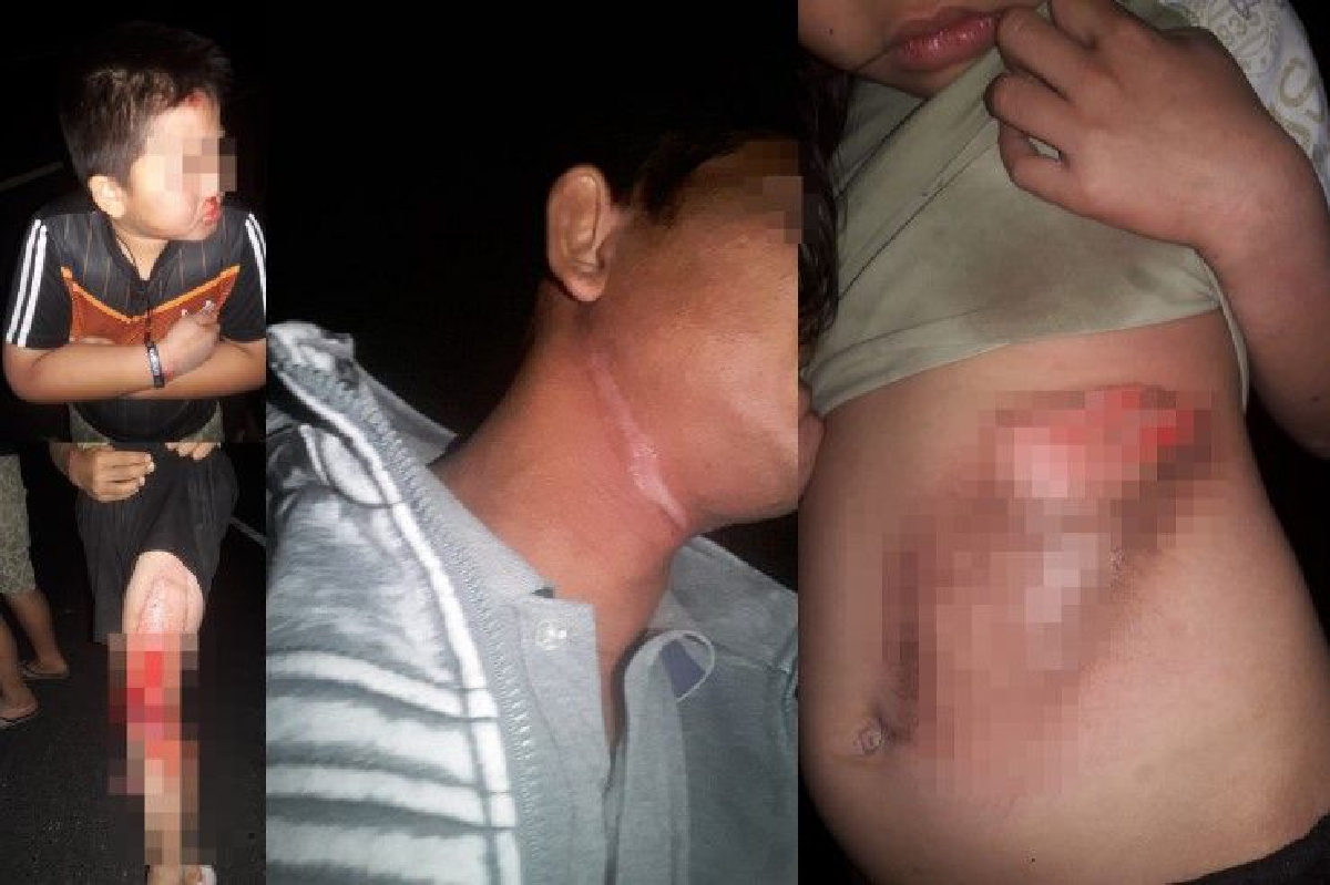 พ่อลูกสองถูกสายไฟห้อยบนถนนเกี่ยวจยย.คว่ำ-ถามใครจะรับผิดชอบ? พ่อลูกสองถูกสายไฟห้อยบนถนนเกี่ยวจยย.คว่ำ-ถามใครจะรับผิดชอบ?
