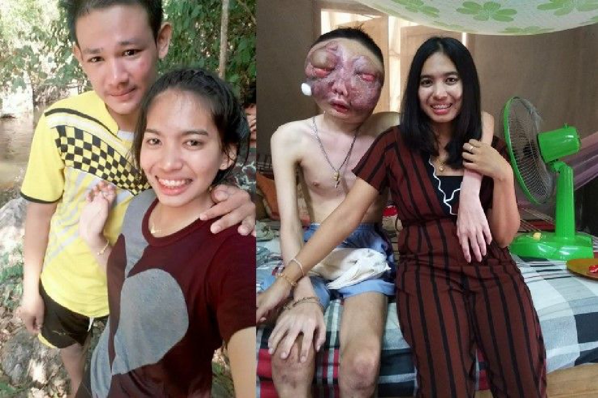 สังคมให้กำลังใจ "โพ โชคชัย" ป่วยมะเร็งดวงตา แพทย์ระบุพบได้น้อยมาก สังคมให้กำลังใจ "โพ โชคชัย" ป่วยมะเร็งดวงตา แพทย์ระบุพบได้น้อยมาก
