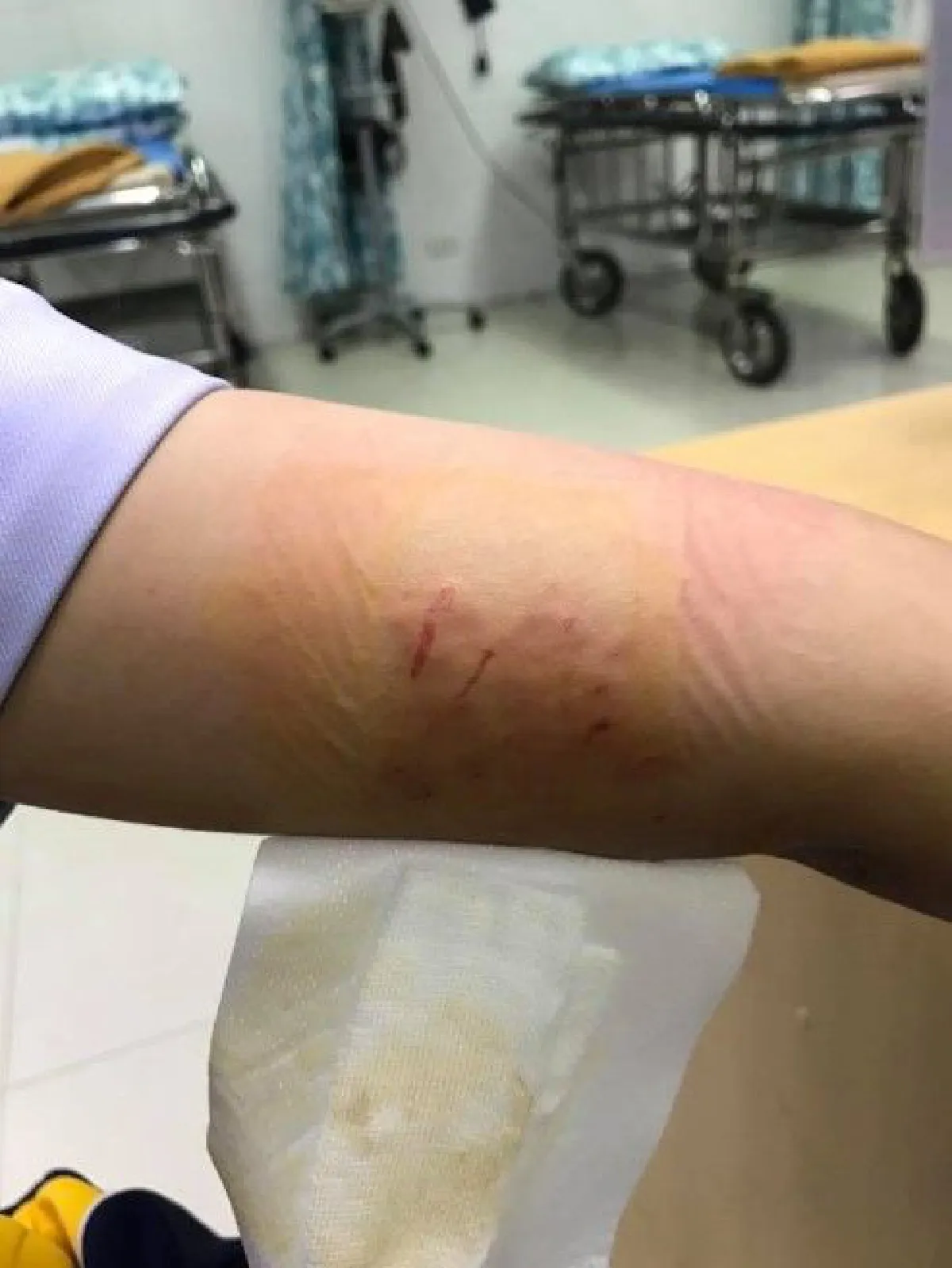 พยาบาลเปิดประสบการณ์ ช่วยเหลือคนไข้เเต่กลับโดนแจ้งความ-ฟ้องศาลเรียกเงินเกือบ 2 ล้าน