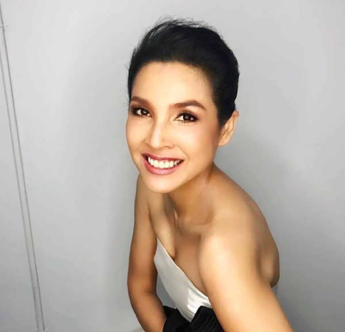 "หน่อย” โพสต์เตือน หลังโดน "แมลงก้นกระดก” กัด จนผิวหนังพุพอง