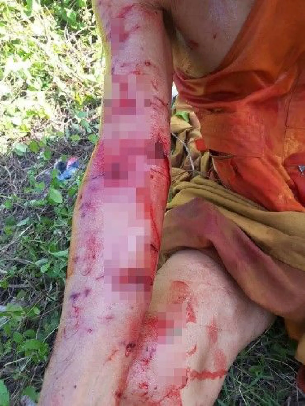 พิทบูล 5 ตัวรุมขย้ำกัดพระสงฆ์ ได้แผลเต็มตัว