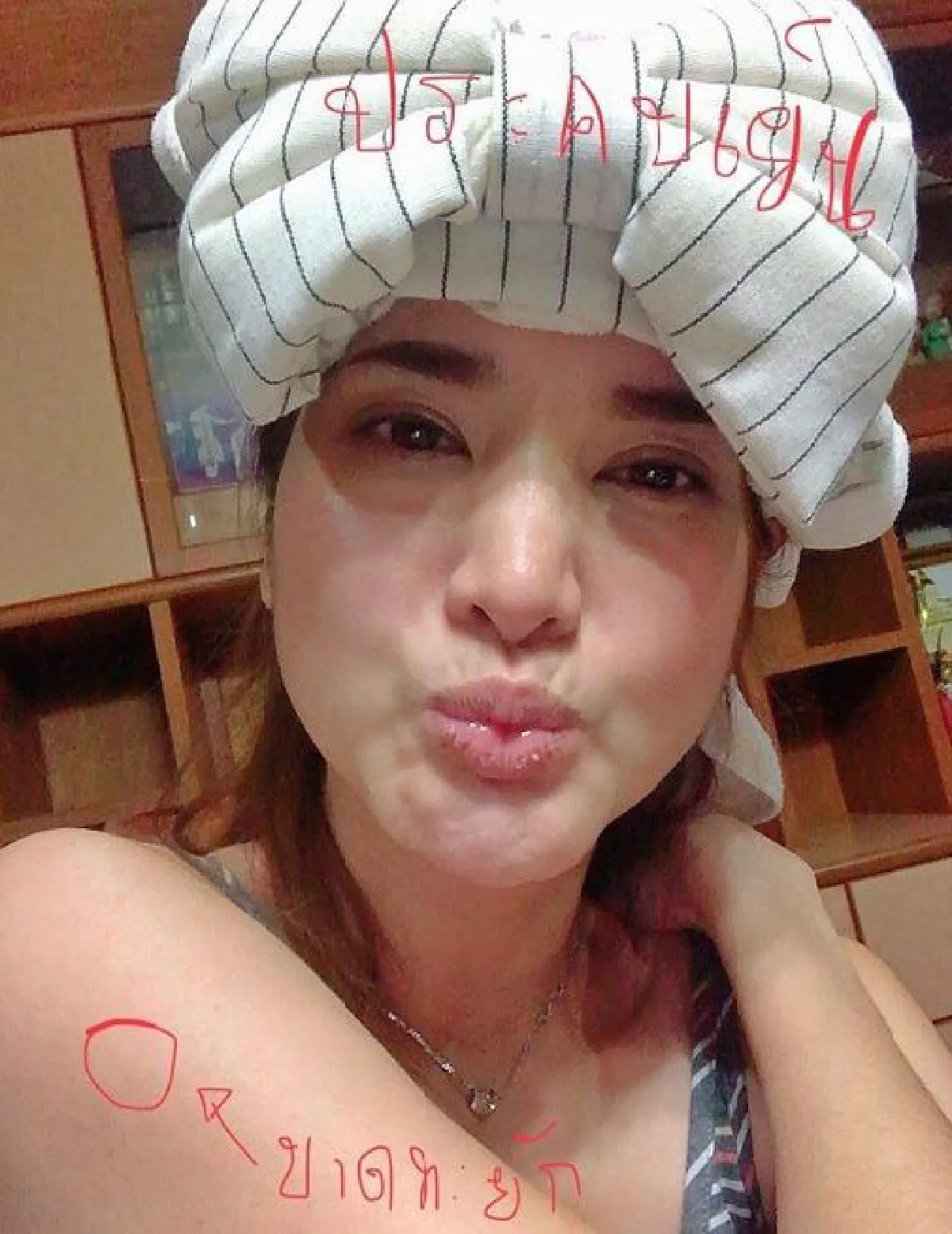 เซ่อซ่าจนได้แผล! ปอย ปวีณา  เดินชนตู้เสาไฟฟ้า หน้าผากแตกเป็นรู