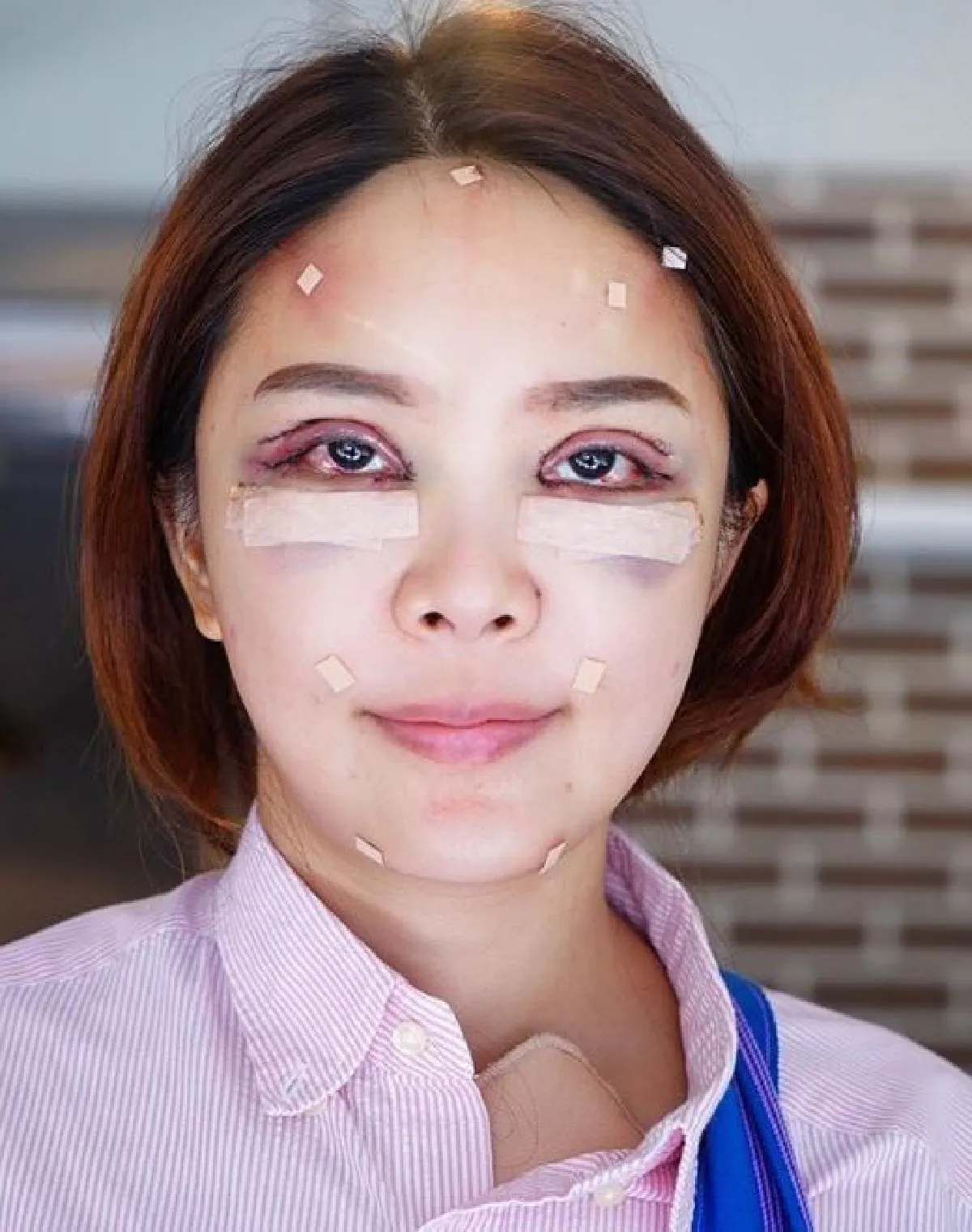 ช้ำทั้งหน้าระบมทั้งตัว! หญิงแย้ อัพเดทสภาพล่าสุด..หลังศัลยกรรมครั้งใหม่ (คลิป)