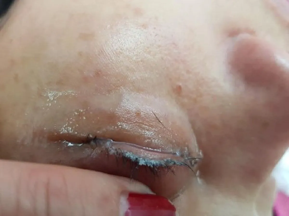 เจอช่างเสริมสวยใช้กาวตราช้างต่อขนตาให้