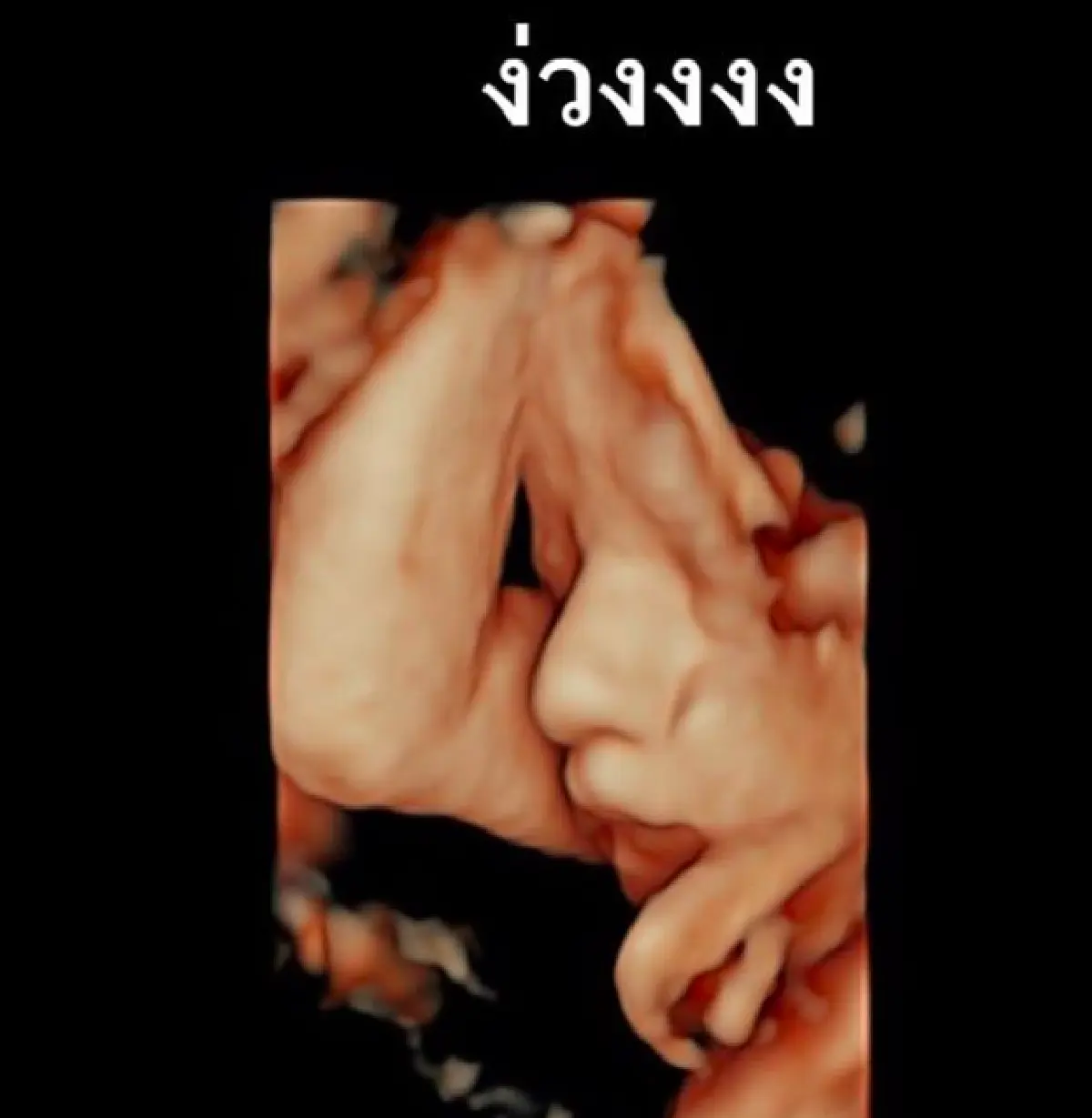 ดั้งโด่งมาแต่ไกล! “เมญ่า” โชว์ภาพอัลตราซาวด์เบบี้ เป๊ะตั้งแต่ในท้อง
