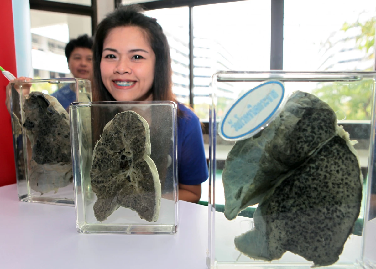 รณรงค์ประเทศไทย ให้ปลอดวัณโรค