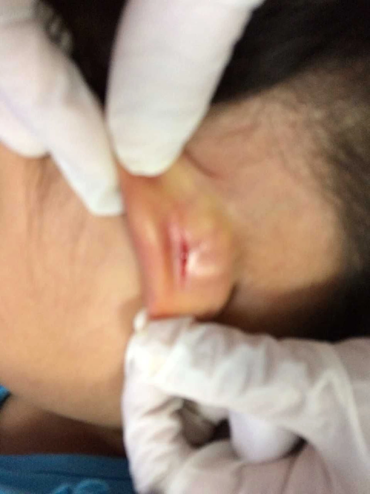 ครูพี่เลี้ยง-ผู้บริหารโรงเรียนเข้าพบตร. ขอโทษพ่อแม่เด็กหลังบิดหูจนเป็นแผล