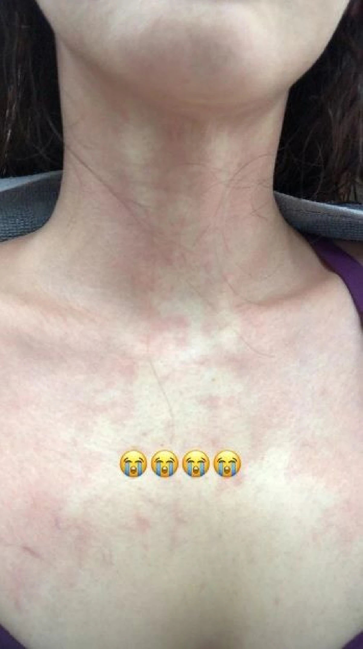 อาการล่าสุดของ อั้ม พัชราภา หลังป่วยนอนรพ.ให้น้ำเกลือกลางดึก