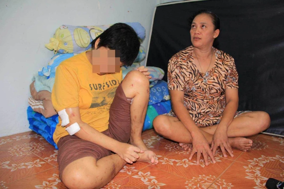 จ้างเด็กข้างบ้านวัย 12 ปีเลี้ยงลูกตาบอด-ถูกมีดกรีดทั่วตัว