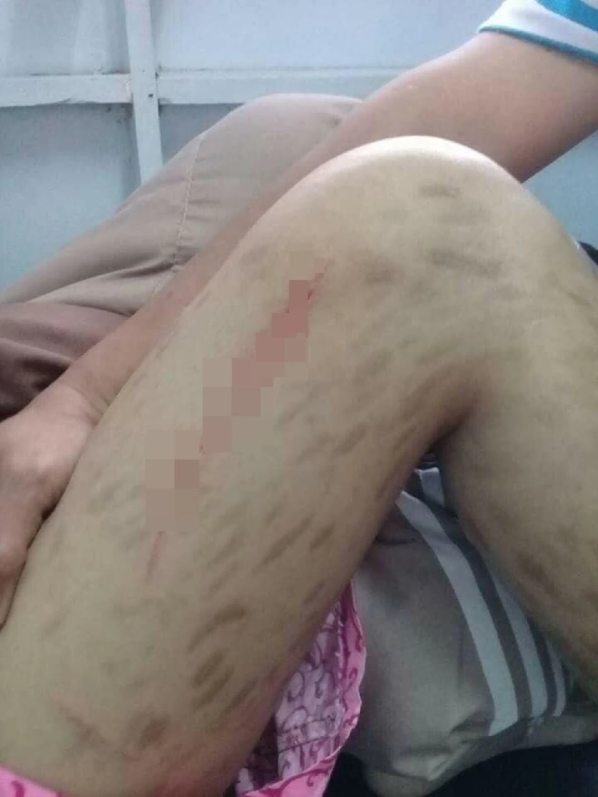 จ้างเด็กข้างบ้านวัย 12 ปีเลี้ยงลูกตาบอด-ถูกมีดกรีดทั่วตัว