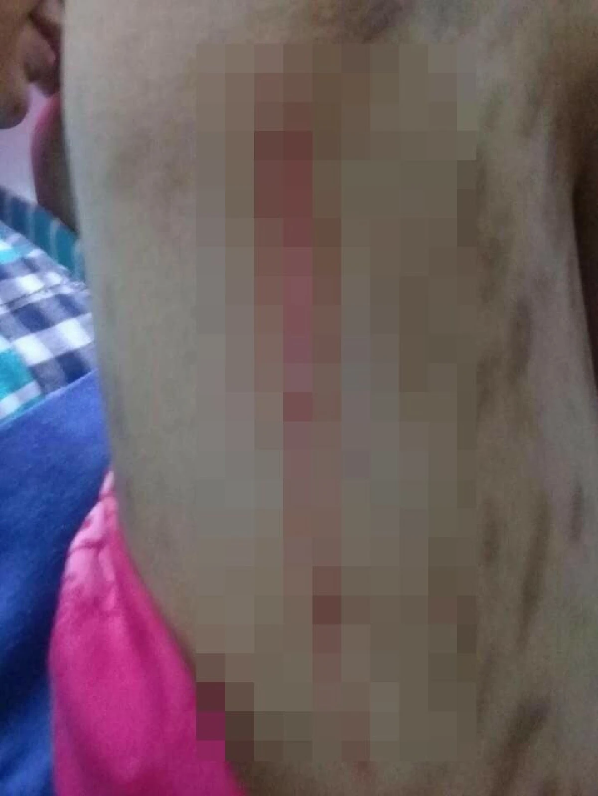 จ้างเด็กข้างบ้านวัย 12 ปีเลี้ยงลูกตาบอด-ถูกมีดกรีดทั่วตัว