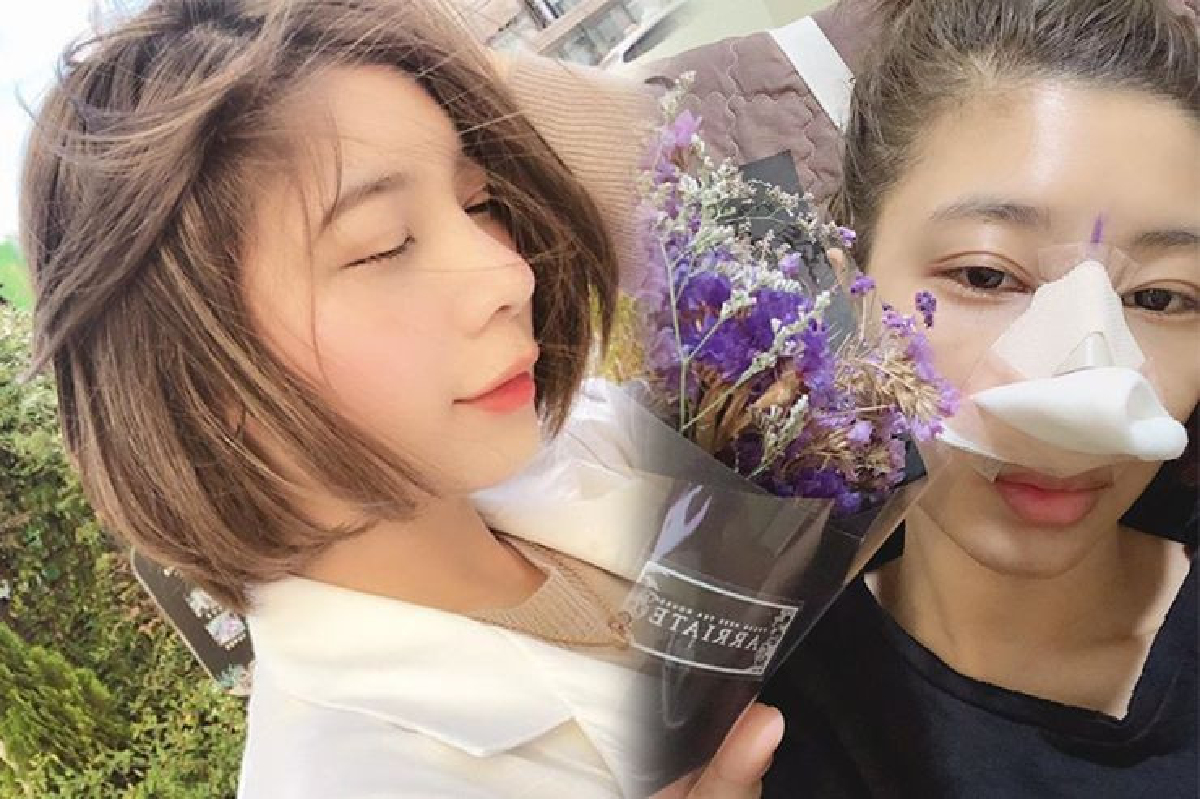 “กุ๊บกิ๊บ” อวดโฉมจมูกใหม่ หลังบินตรงเกาหลีอัพดั้ง พร้อมพาครอบครัวเที่ยว “กุ๊บกิ๊บ” อวดโฉมจมูกใหม่ หลังบินตรงเกาหลีอัพดั้ง พร้อมพาครอบครัวเที่ยว